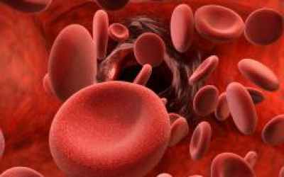 Thick blood (hypercoagulability): Causes, treatments, and symptoms