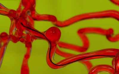 This Snake Robot is Designed to Crawl Through Blood Vessels in the Brain | Digital Trends
