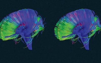 Your Brain Has A "Delete" Button--Here