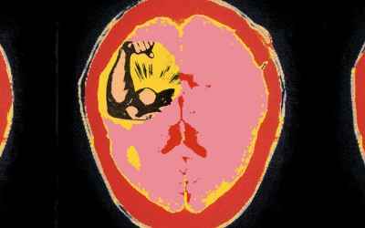 Power Causes Brain Damage