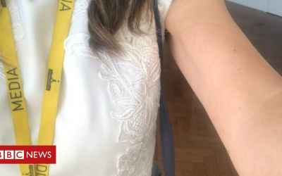 Why this arm caused outrage in Australia